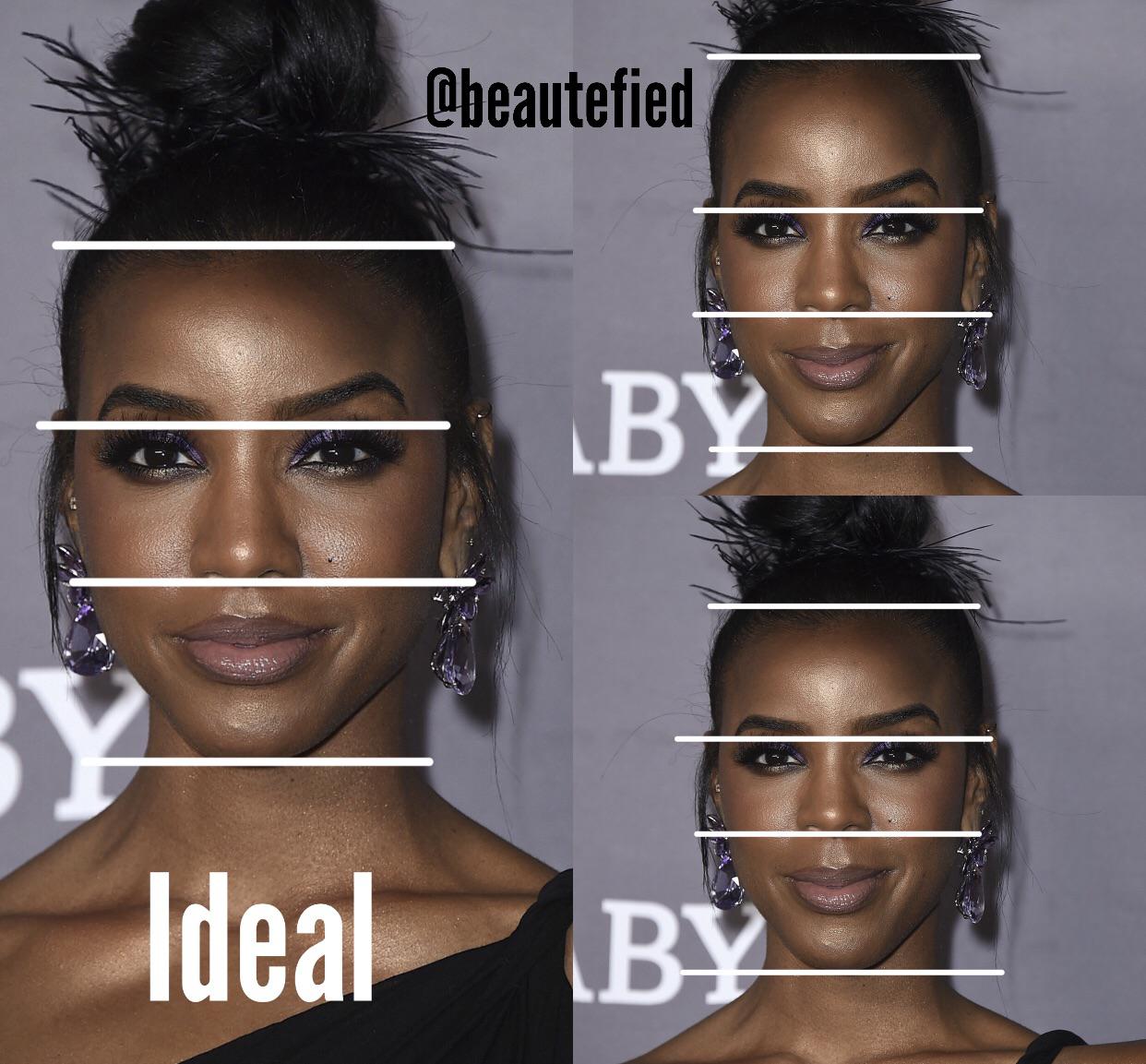 Facial thirds analysis